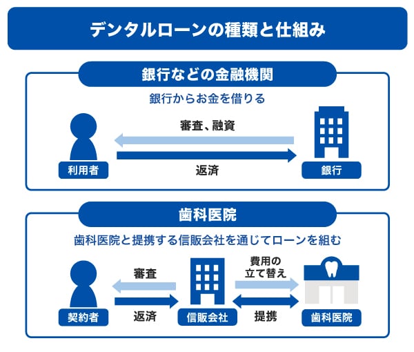 デンタルローンの種類と仕組み